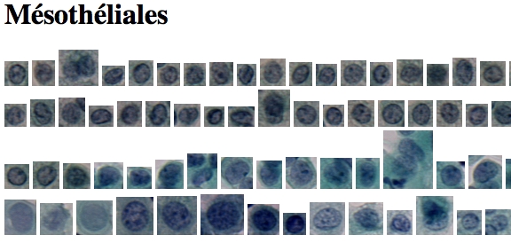 Mesothelial Cells